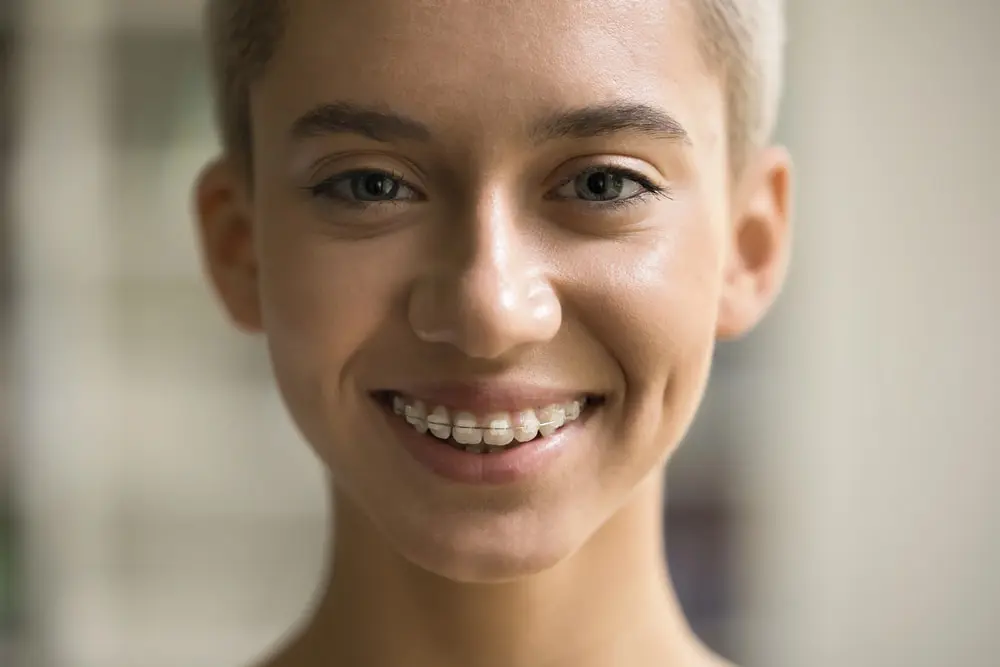 Amidst a blurred background in Kingwood TX, a person with short hair smiles brightly, displaying ceramic braces that subtly align their teeth.
