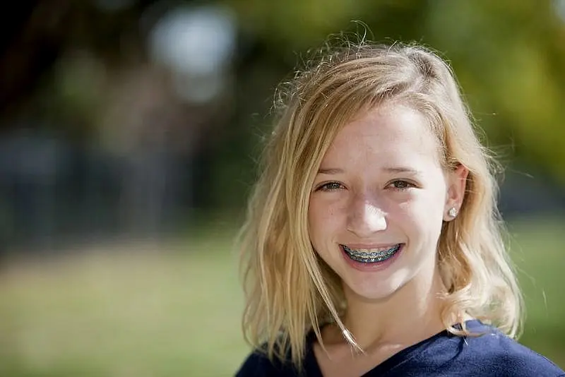 A young girl with braces smiling highlighting the importance of age in teeth treatment planning and execution and choice Paige Orthodontics in Kingwood, TX for solution