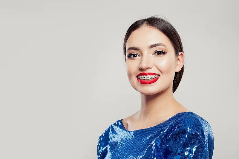 a dark-haired woman with red lipstick smiles wearing braces and a blue sequin top at Paige Orthodontics in Kingwood, TX