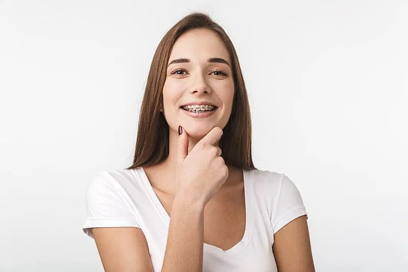 A woman with braces smiling
with treatment result braces at Paige Orthodontics in Kingwood, TX