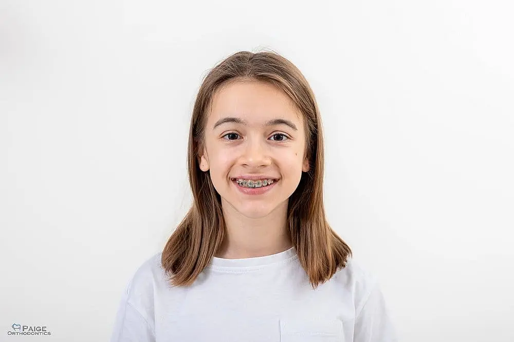 A young girl with straight brown hair and braces smiles at the camera in a white t-shirt, wondering about How Long Do Braces Take in Kingwood TX.