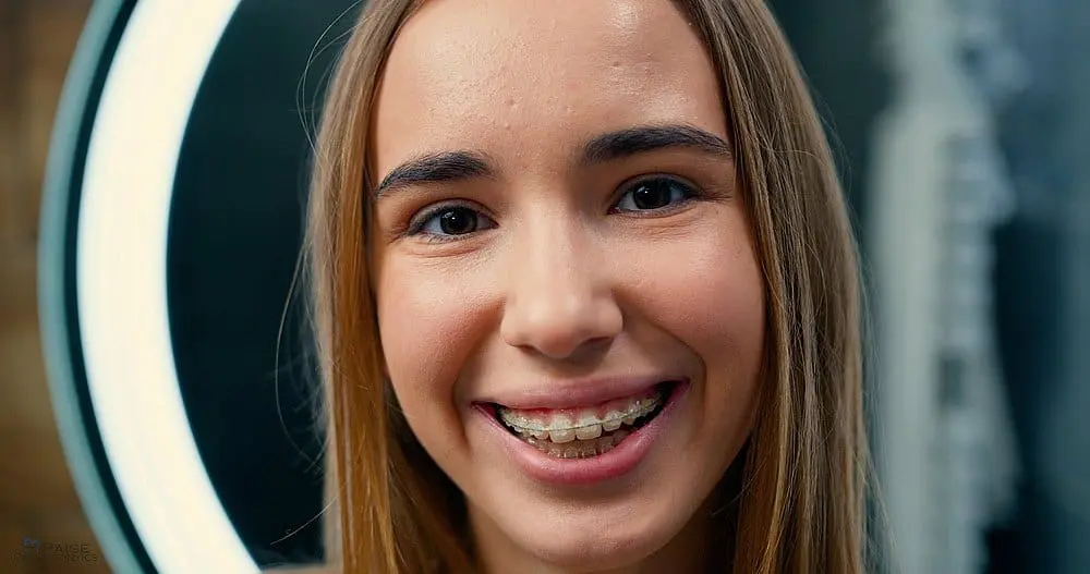 A smiling person with clear braces as one of the alternatives to braces in Kingwood TX.