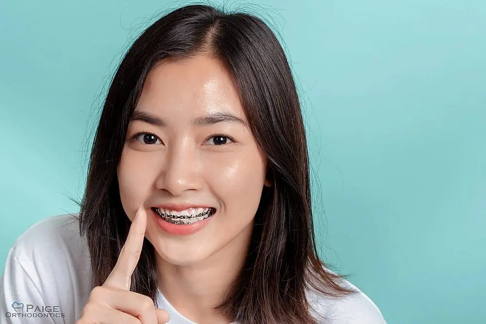 Smiling, a young woman with straight dark hair in front of a light blue background points to her braces in Kingwood TX - How to Get Braces Glue Off Teeth in Kingwood, TX